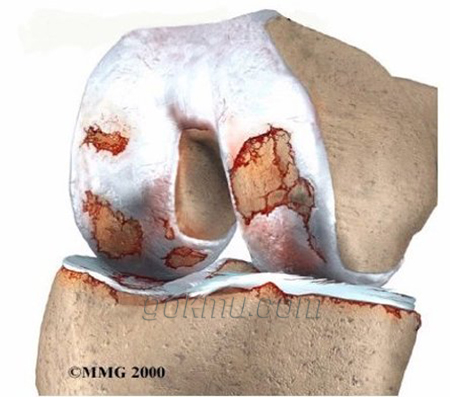 관절의 모습을 그린 그림 구글